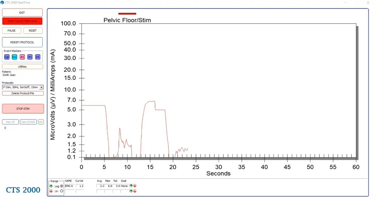 Biofeedback therapy session for pelvic floor muscle training