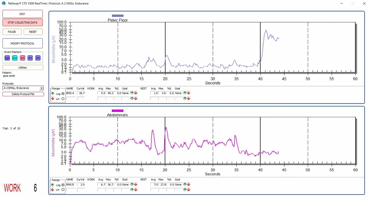 EMG biofeedback machine monitoring pelvic floor muscle contraction