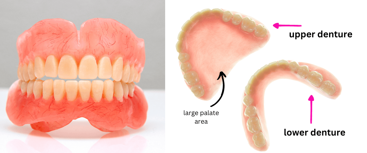 large palate or teeth