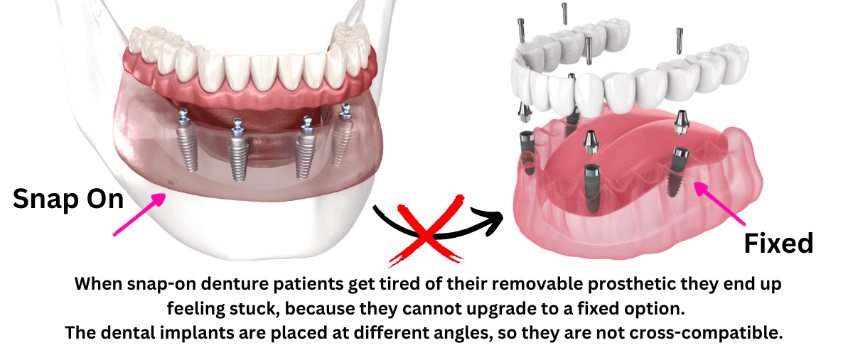 prosthetic dental implant
