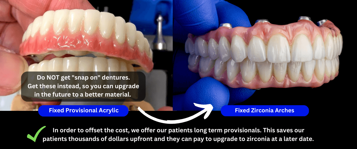 provisional vs zircomia
