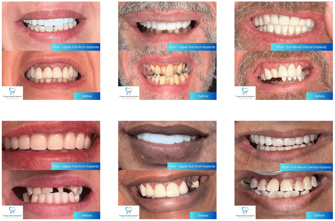 before & afters