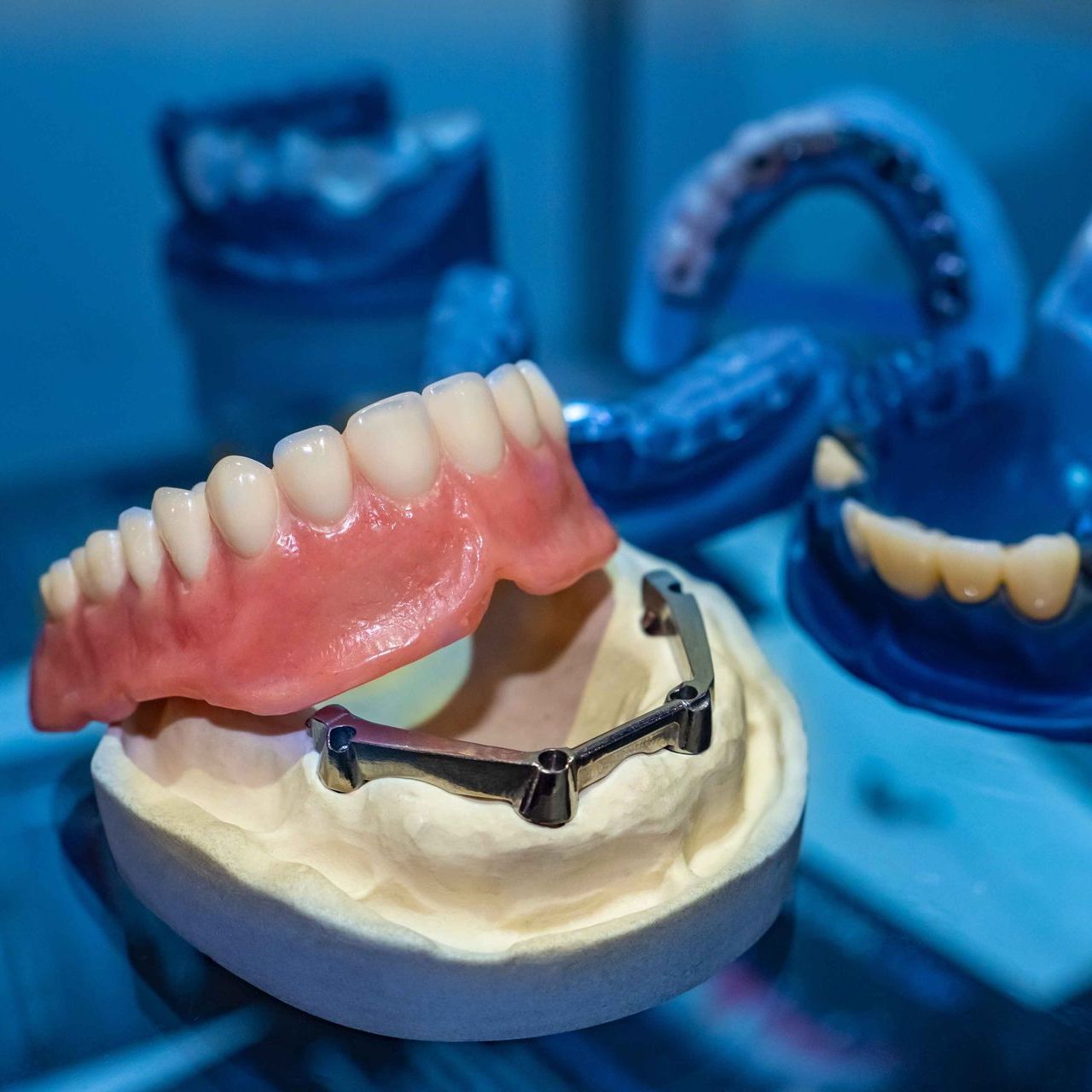 full-teeth-replacement-on-desk