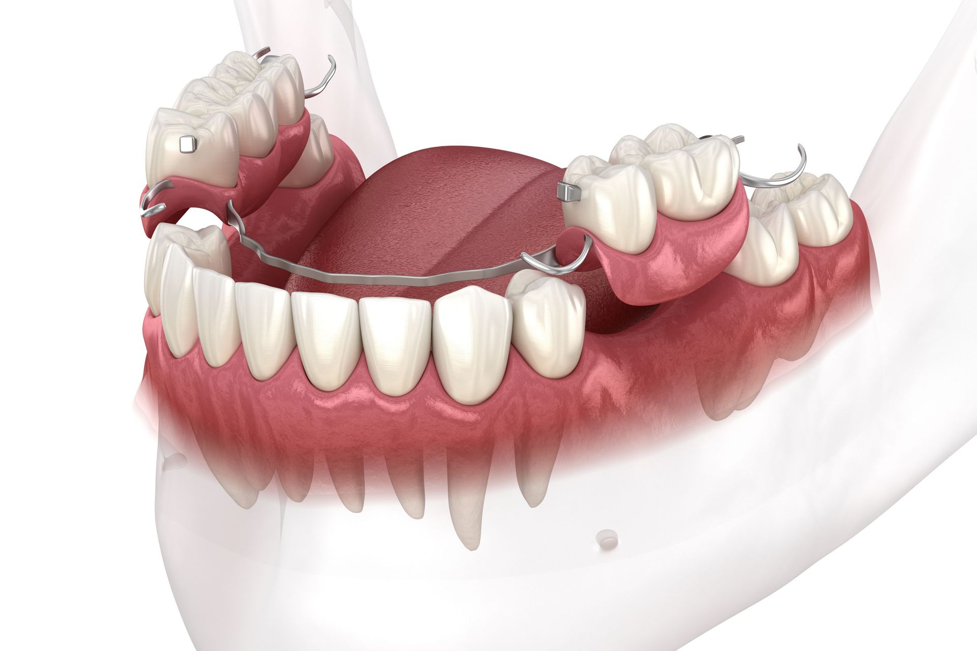 Dental-flippers