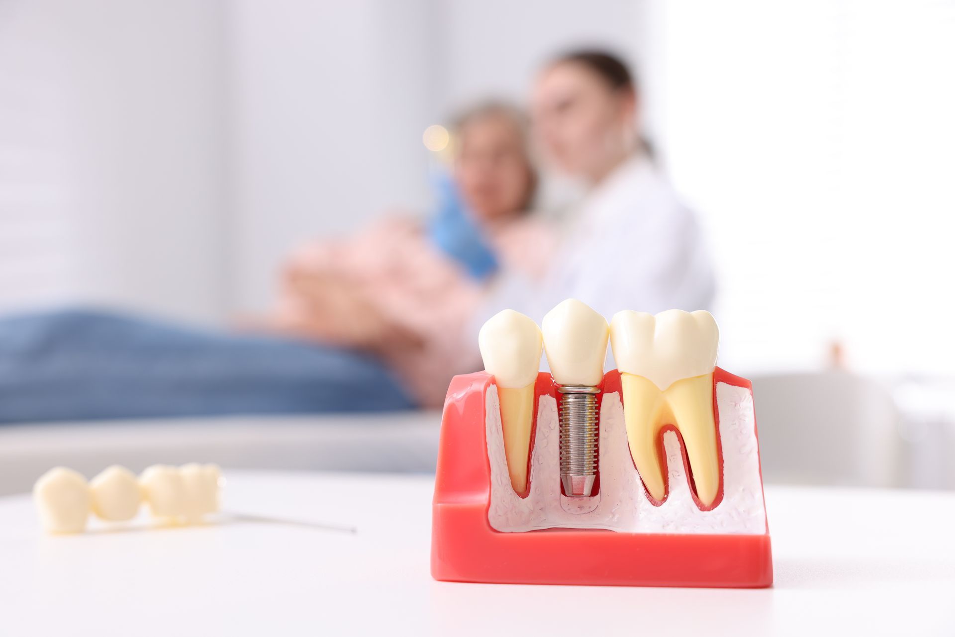 Dental implant model with two implanted teeth on a table, with blurred people in the background