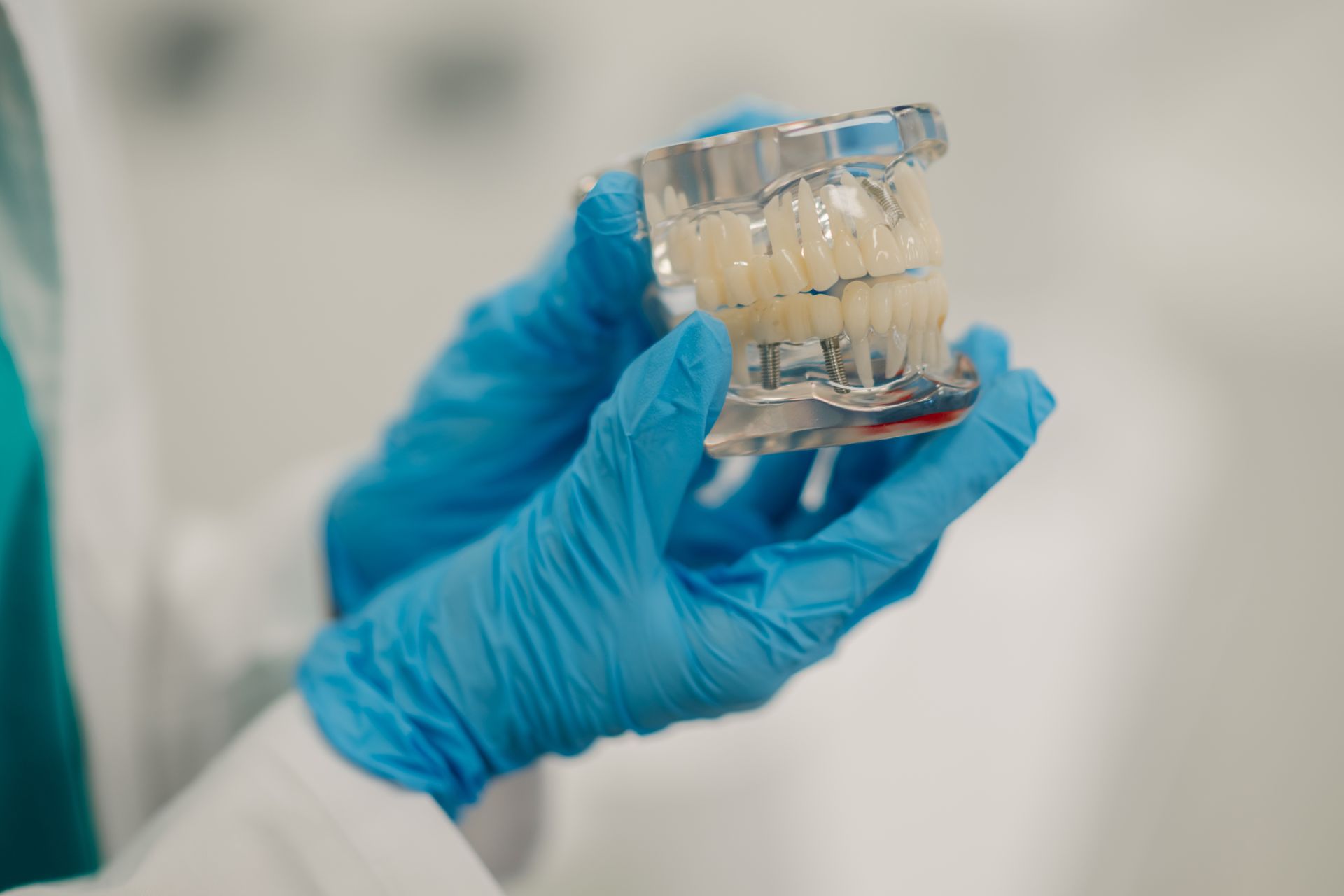 Blue-gloved hands holding a small clear dental model in a clinical setting