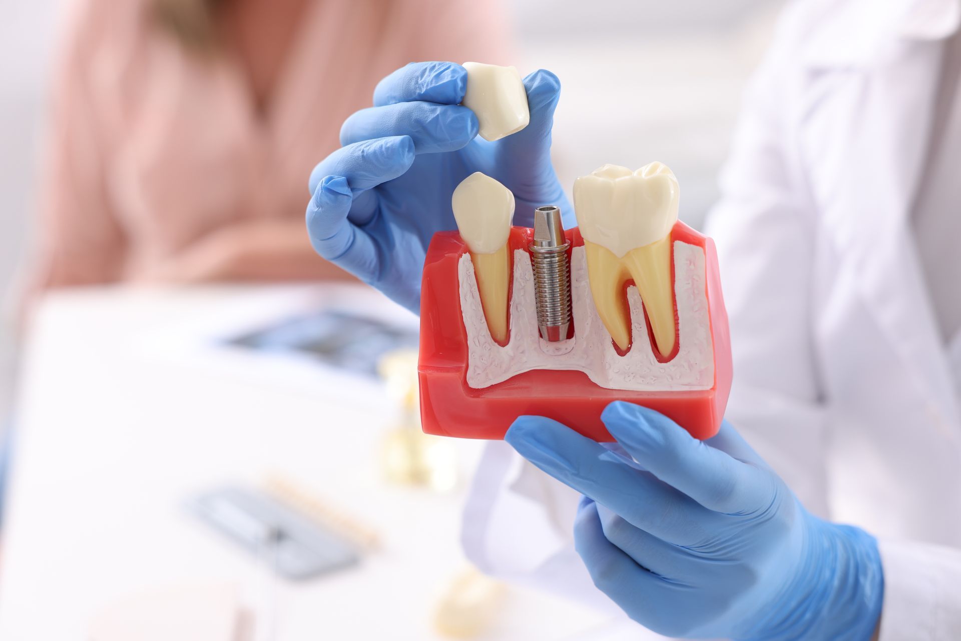 Gloved hands holding a dental implant model with a removable tooth and exposed roots