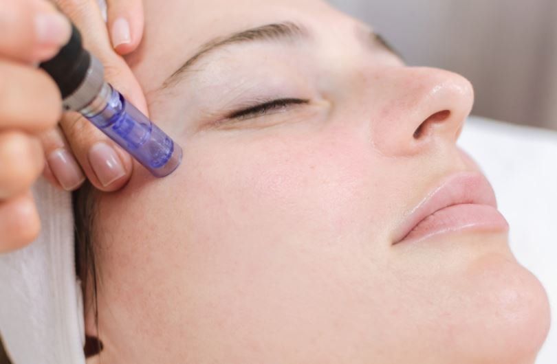 microneedling  brighton