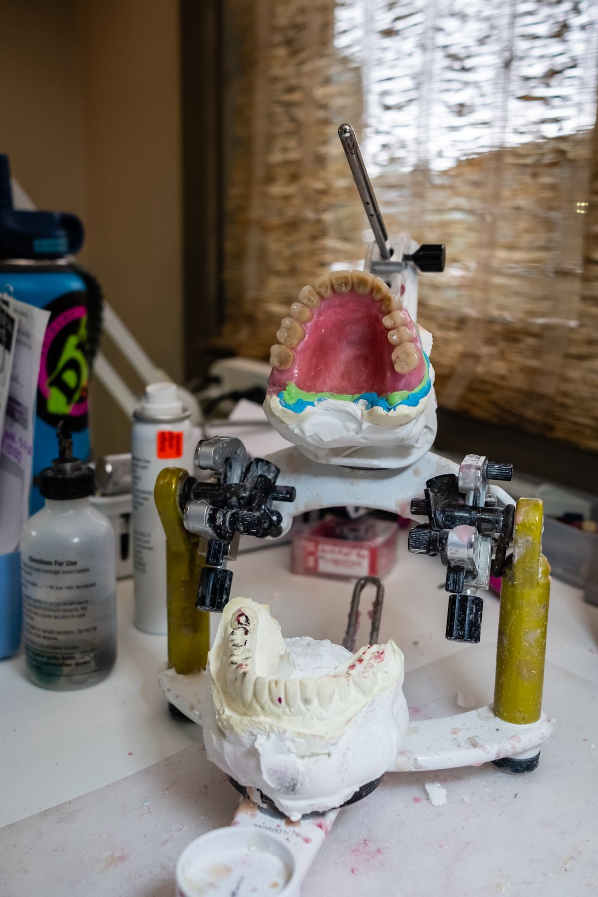Dental molds mounted on a yellow-and-white articulator; in a dental office.