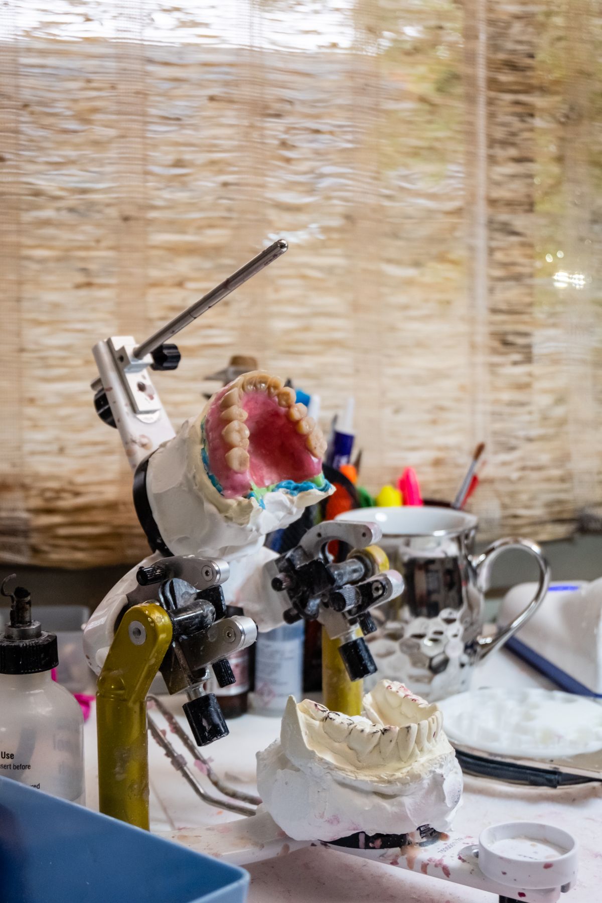 Dental molds in a dental lab setting with tools and a patterned window.
