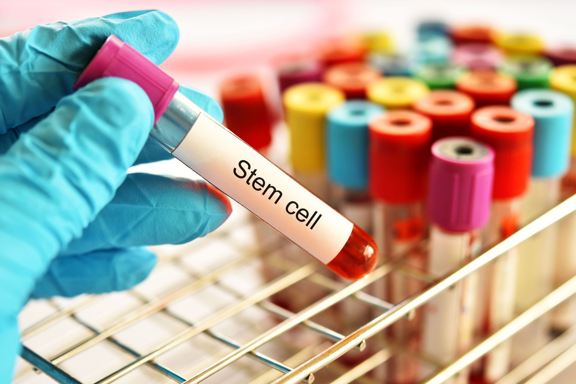 Gloved hand holding labeled stem cell blood tube among colorful lab sample vials