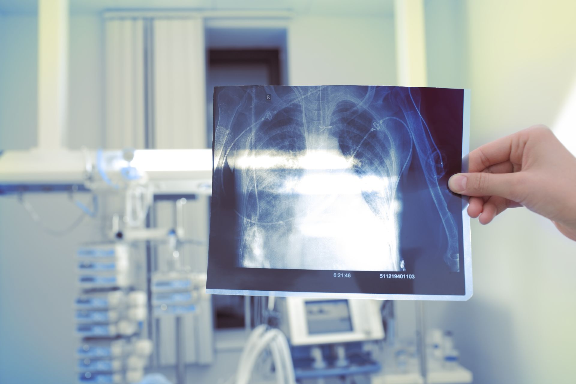 Document titled Drug Test Results showcasing instant drug screening, calculator, pen, glasses. A person in a hospital room holds an x-ray image, examining it closely for medical evaluation.