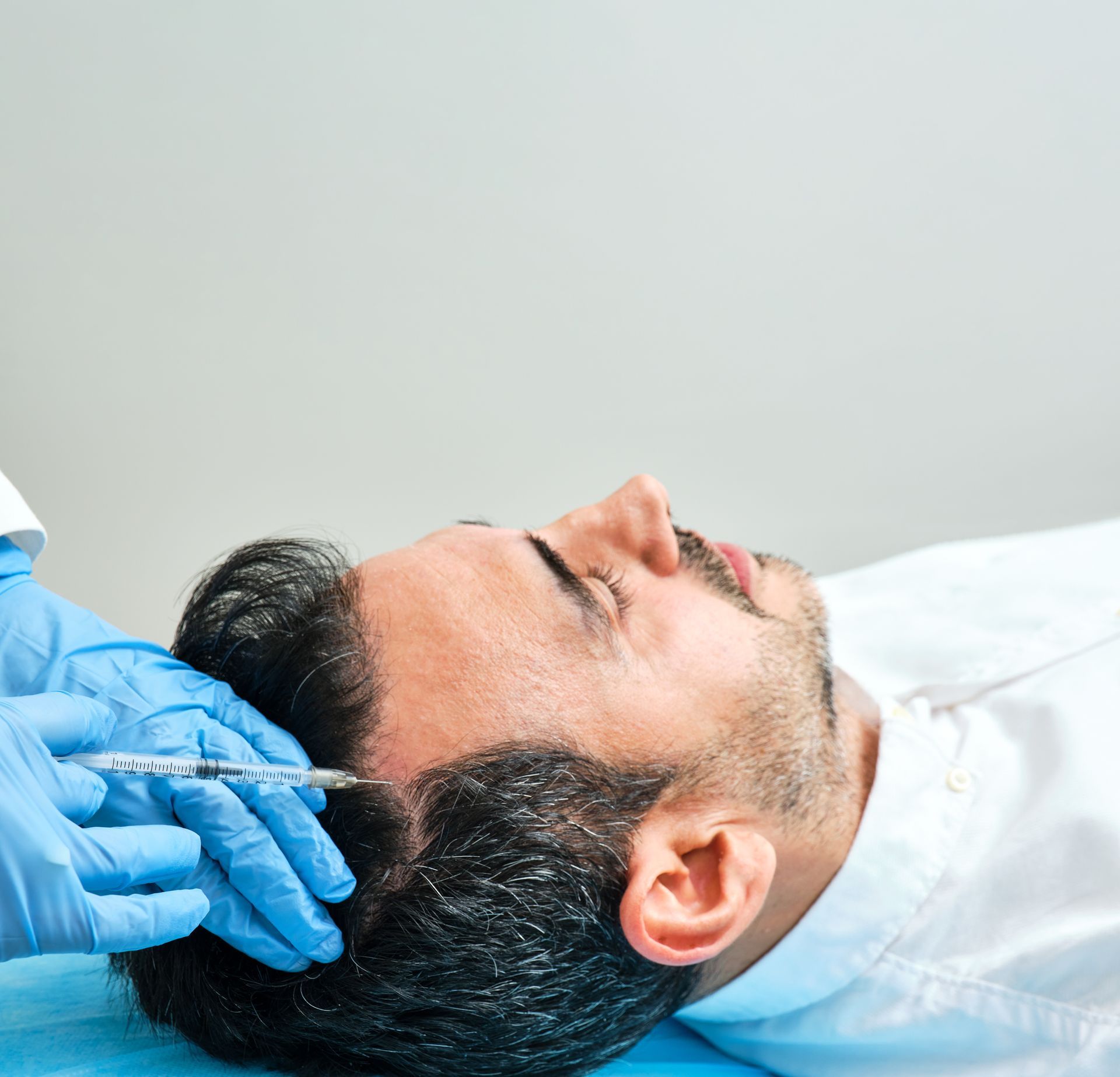 Hairfiller Haarausfall Behandlung