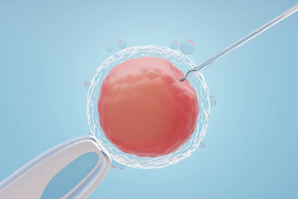 Illustration of IUI treatment in Southlake at Precision IVF showing sperm being placed near an egg