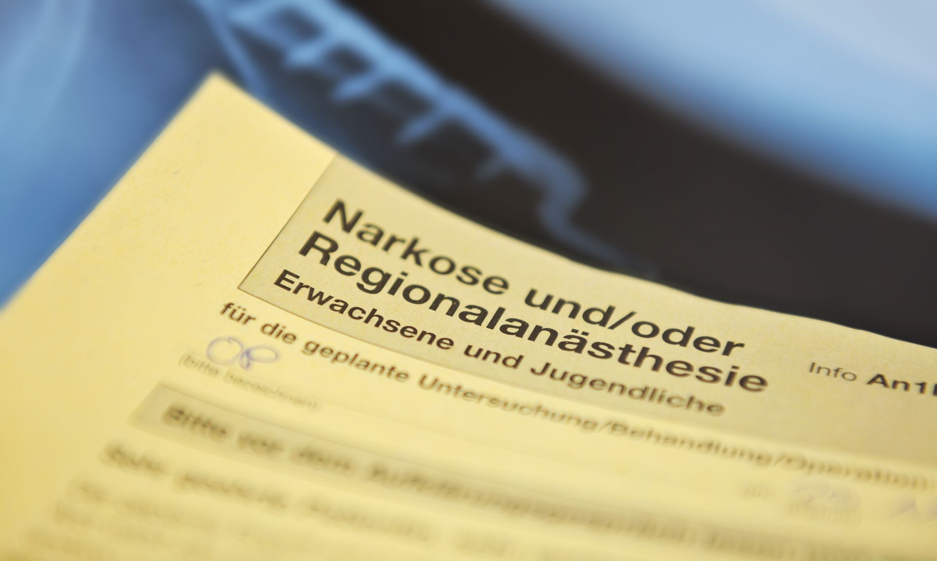 Ein gelbes Stück Papier mit dem Wort Narkose darauf