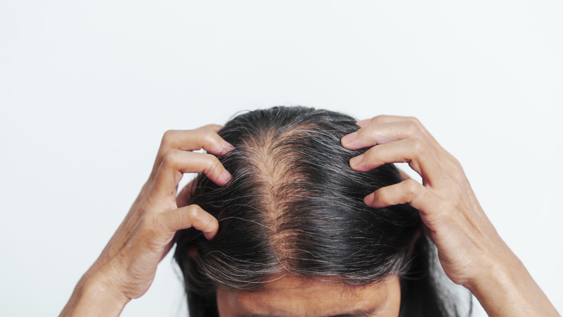 Hands scratching a thinning scalp with visible hair loss on a white background