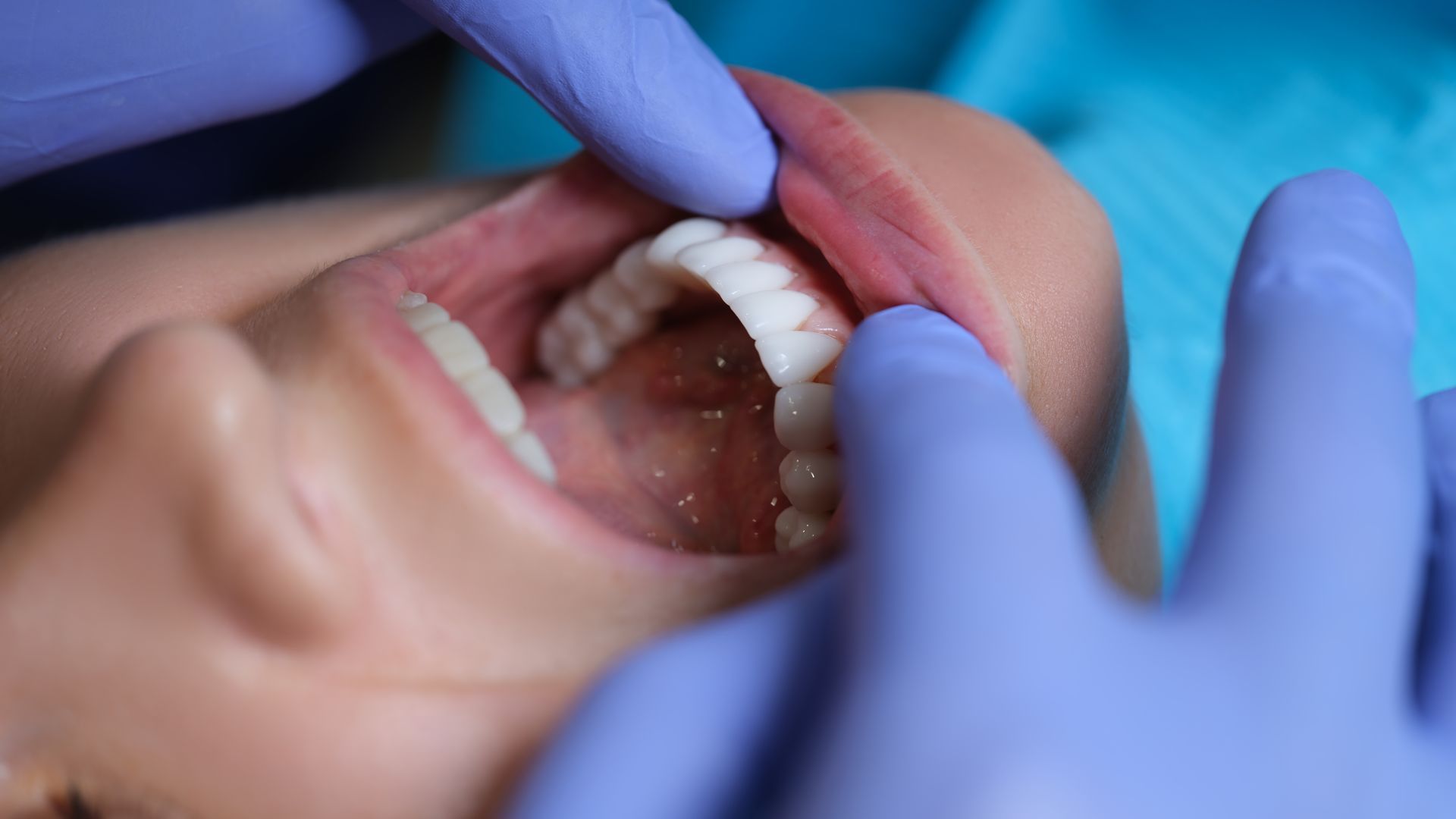 Close-up of gloved hands examining an open mouth with dental tools during a dental exam Close-up of gloved hands examining an open mouth with dental tools during a dental exam