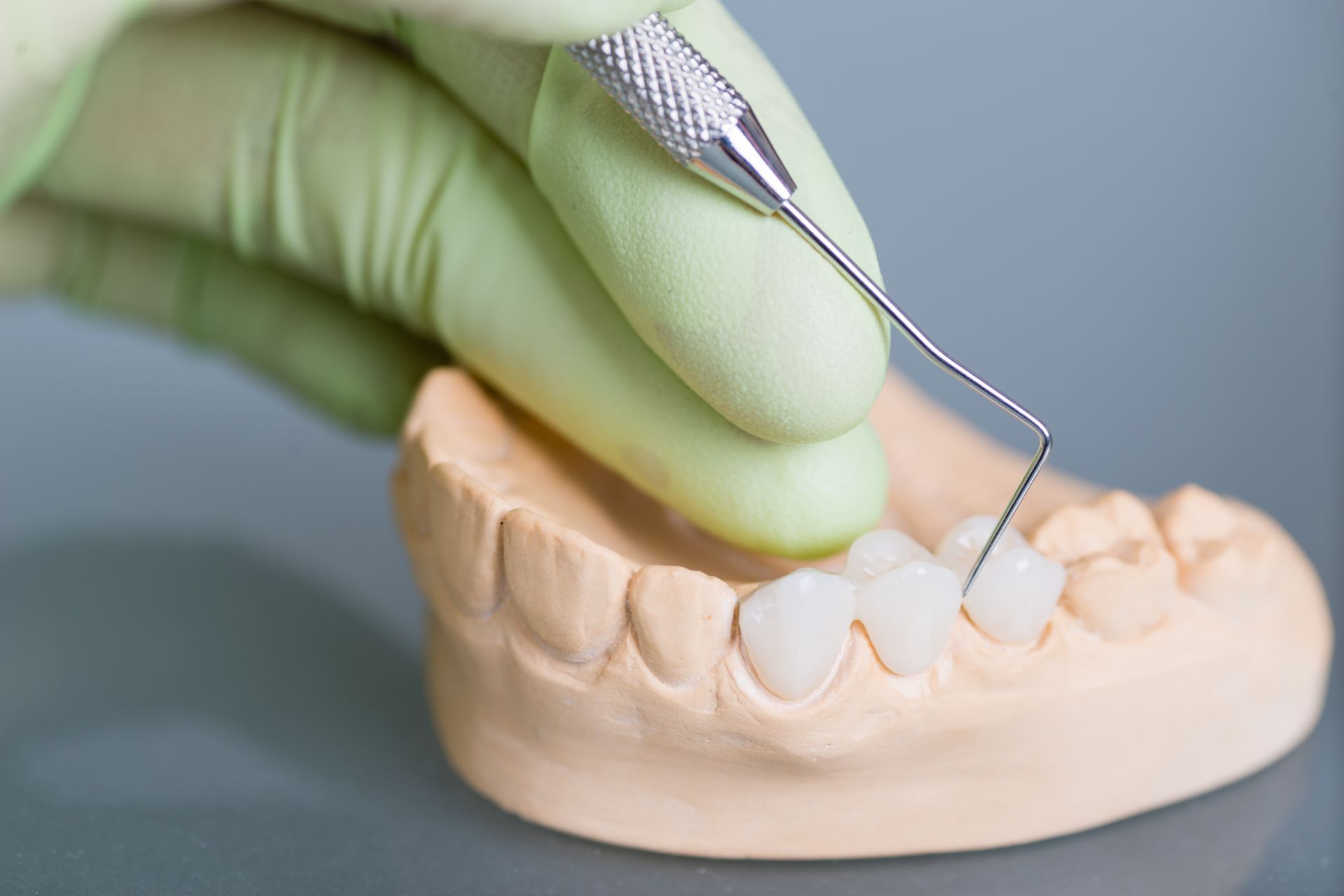 Gloved hand using dental tool on a plaster dental mold Gloved hand using dental tool on a plaster dental mold