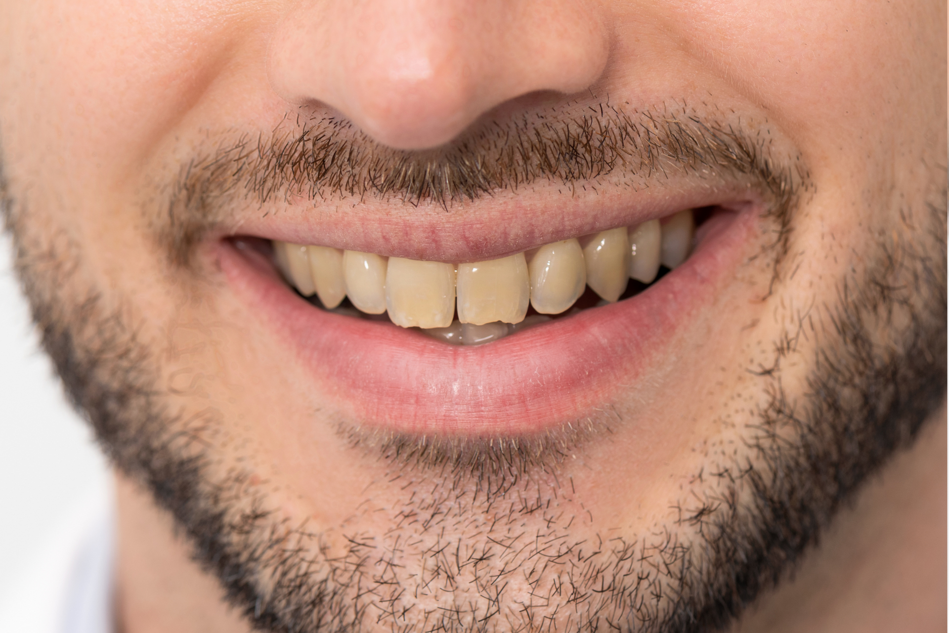 A close up of a man 's mouth with a beard and teeth.