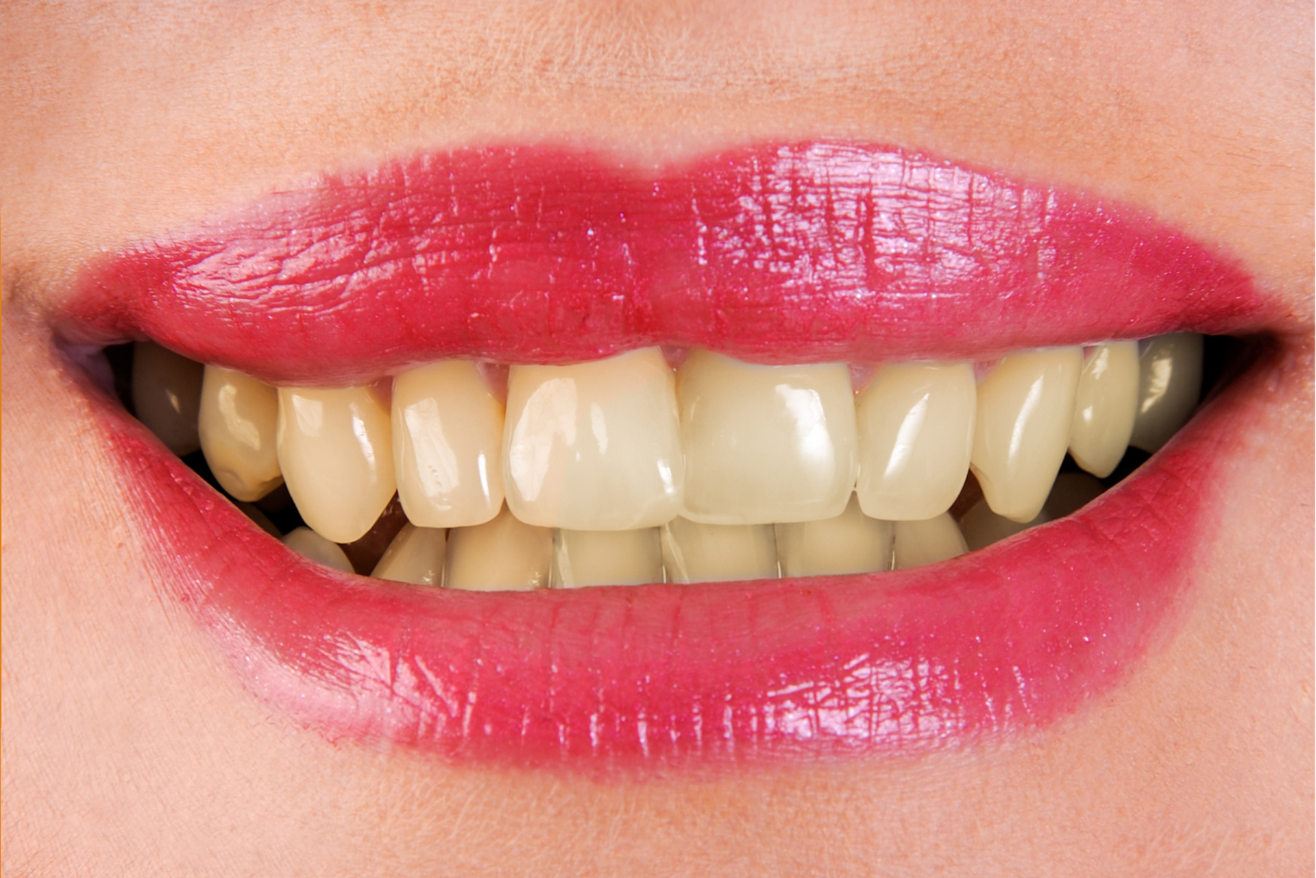 A close up of a woman 's mouth with red lips and white teeth.