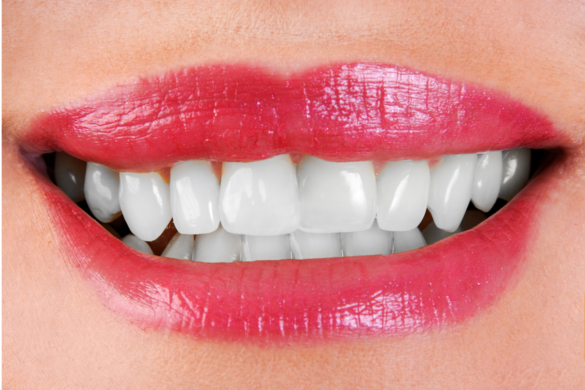 A close up of a woman 's mouth with white teeth and red lips.