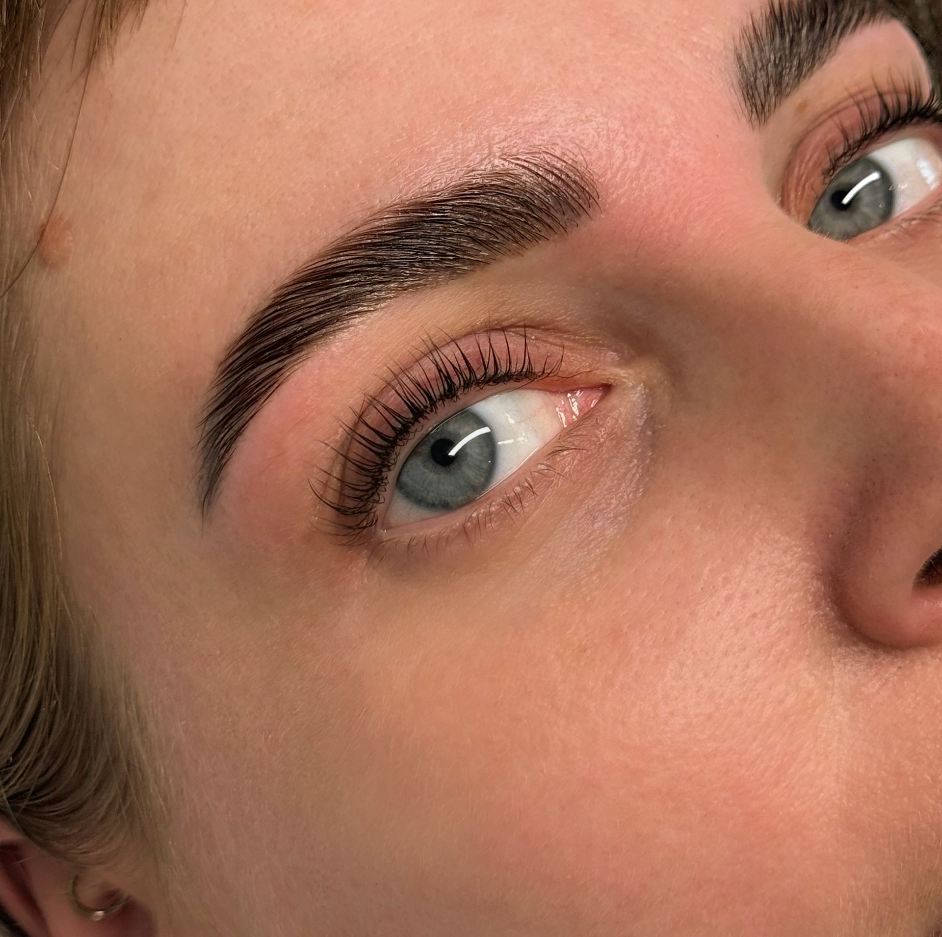 Browlifting