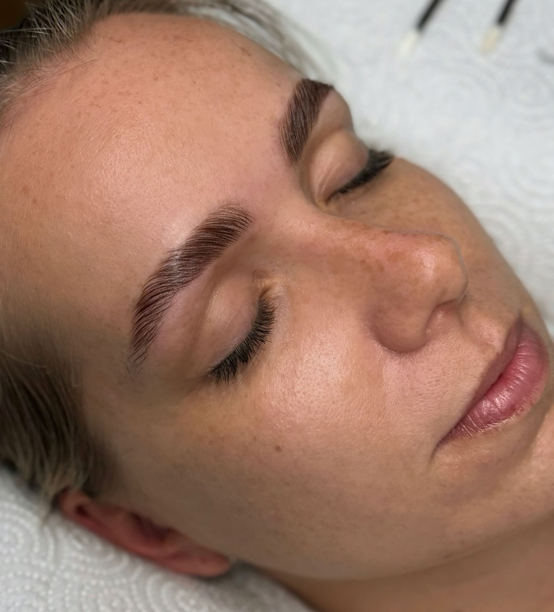 Browlifting