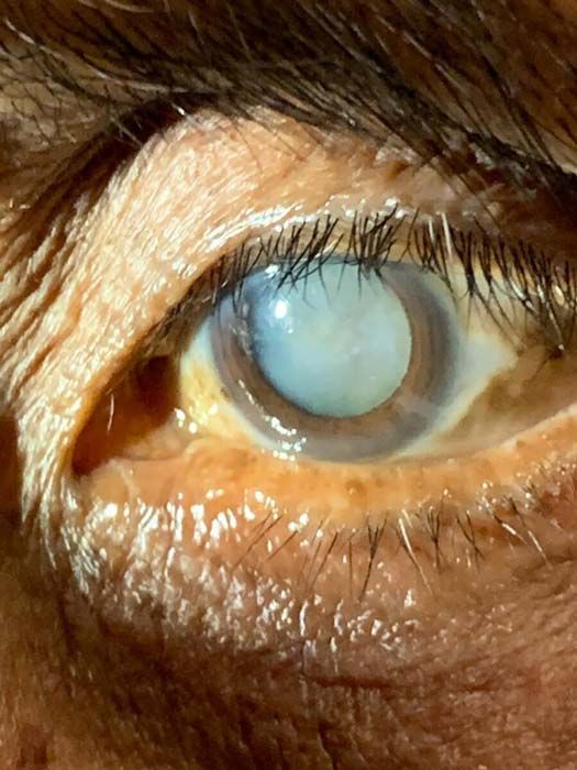 OFTALMOLOGÍA TUXPAN - atendemos el problema a la brevedad OFTALMOLOGÍA TUXPAN - atendemos el problema a la brevedad