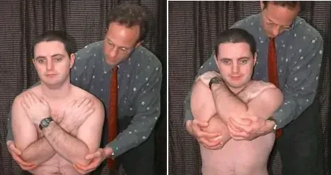 elevation test for thoracic outlet syndrome