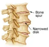 cervical spine