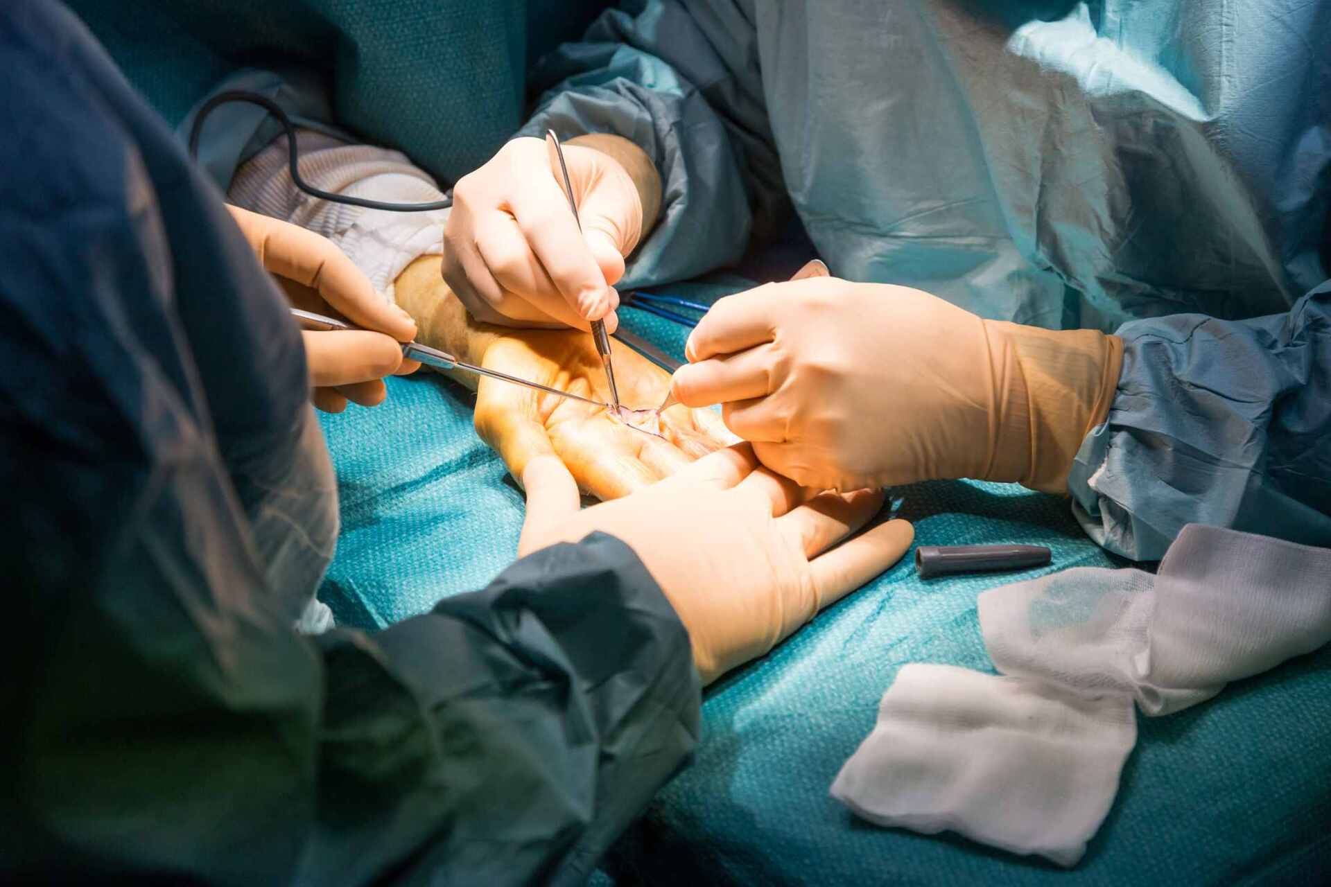doctors performing hand surgery