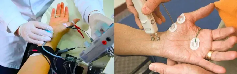 electrodiagnostic tests for carpal tunnel