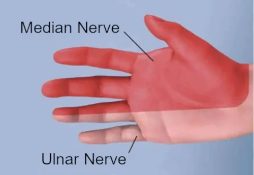 median nerve distribution in the hand