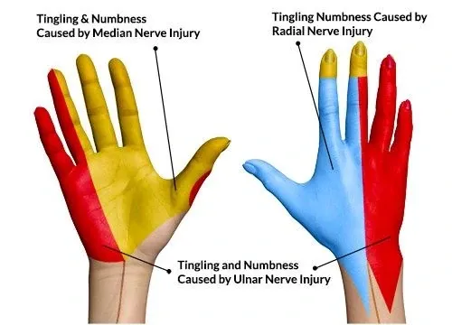 distribution of the hand's nerves