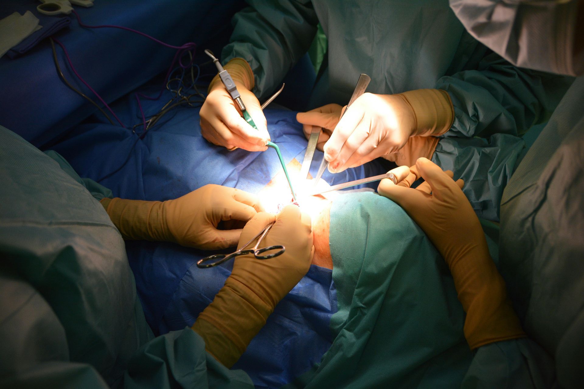 doctors performing surgery