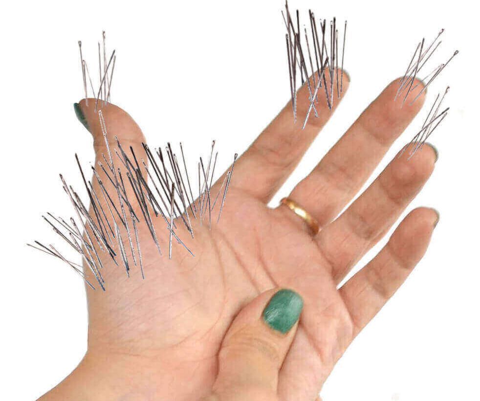 pins & needles feeling in a hand