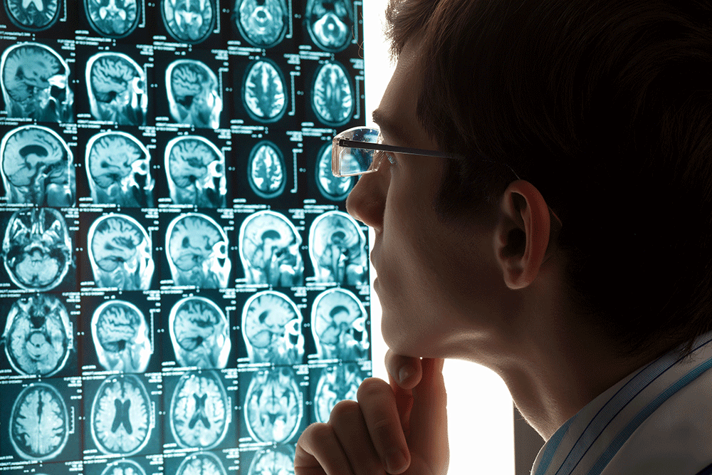 A person in glasses looking thoughtfully at a display of multiple brain MRI scans.