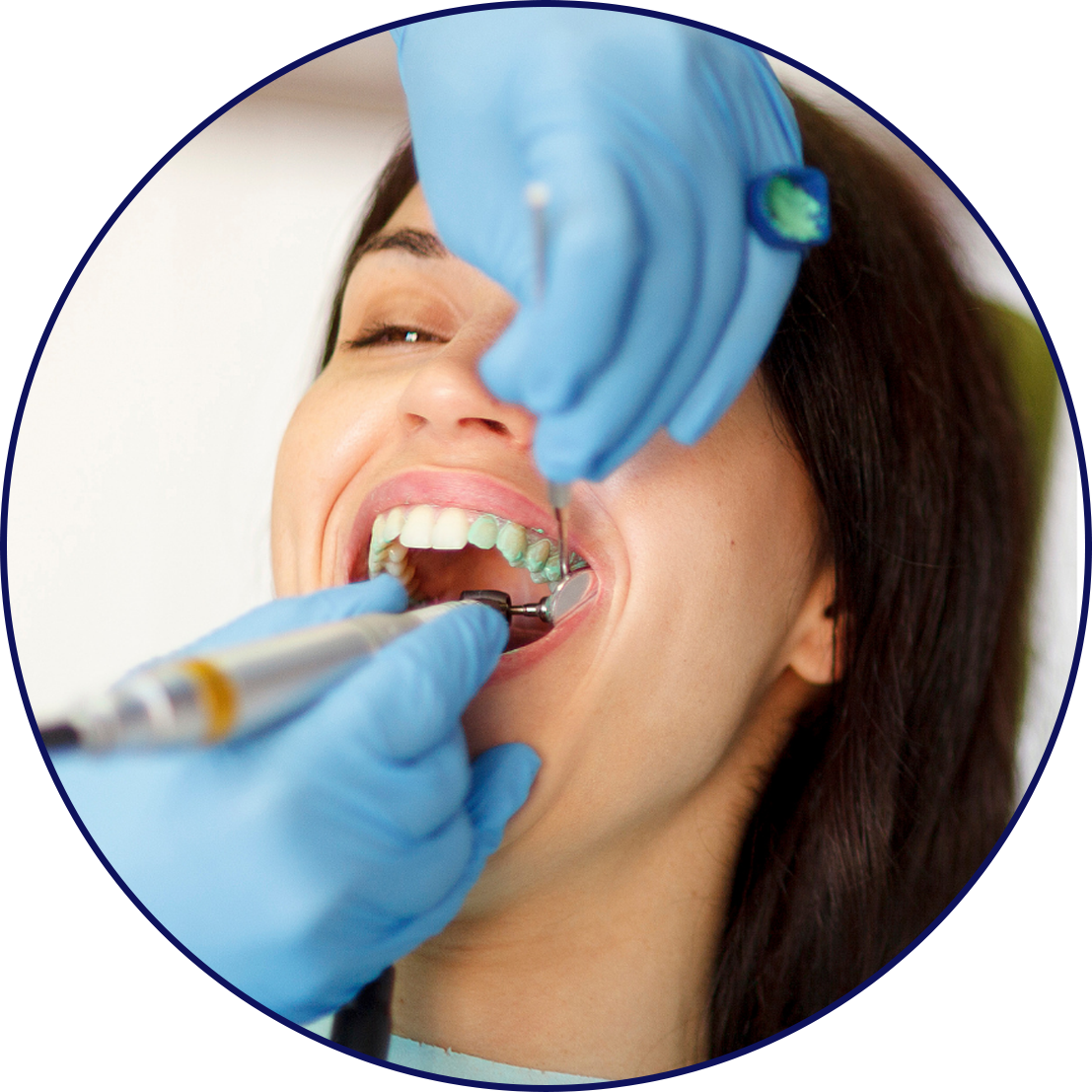 Teeth Scaling • Health First Dental Hygiene • New Hamburg, ON