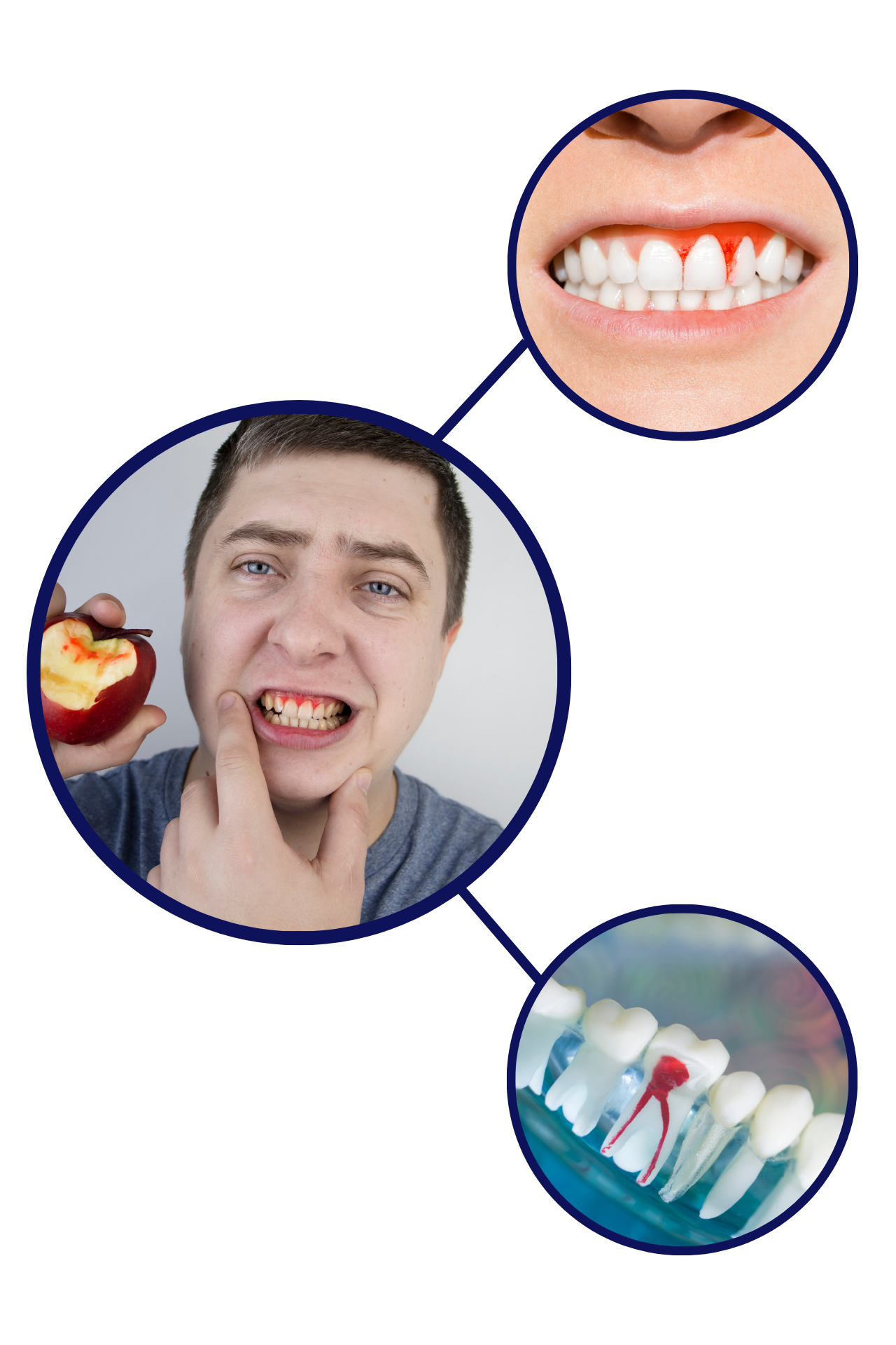 a man with bleeding gums bit an apple