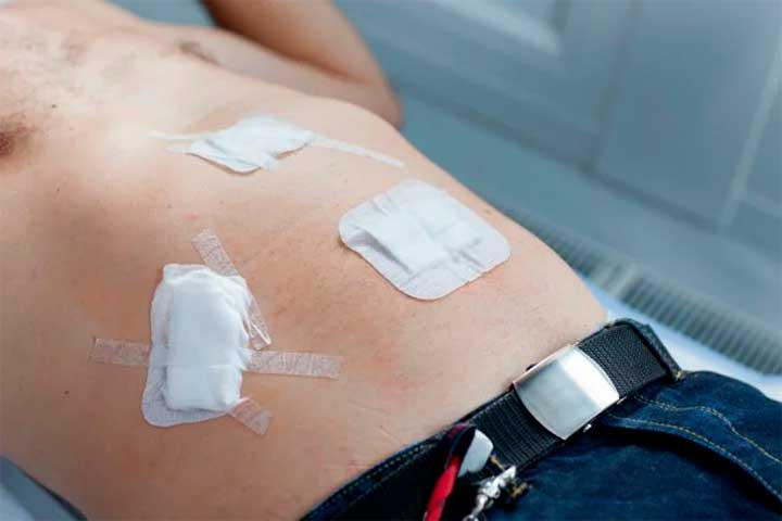 DR. ARMANDO MELERO VELA - Cirugía laparoscópica