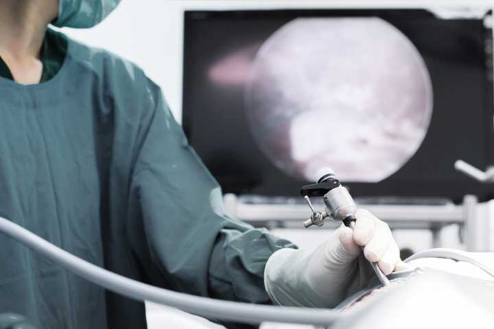 DR. ARMANDO MELERO VELA - Laparoscopia