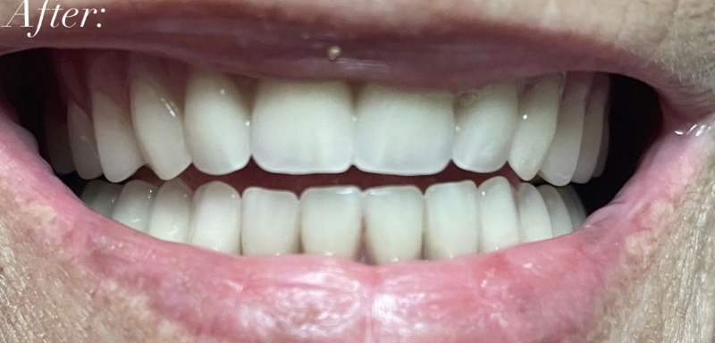 After Smile Gallery