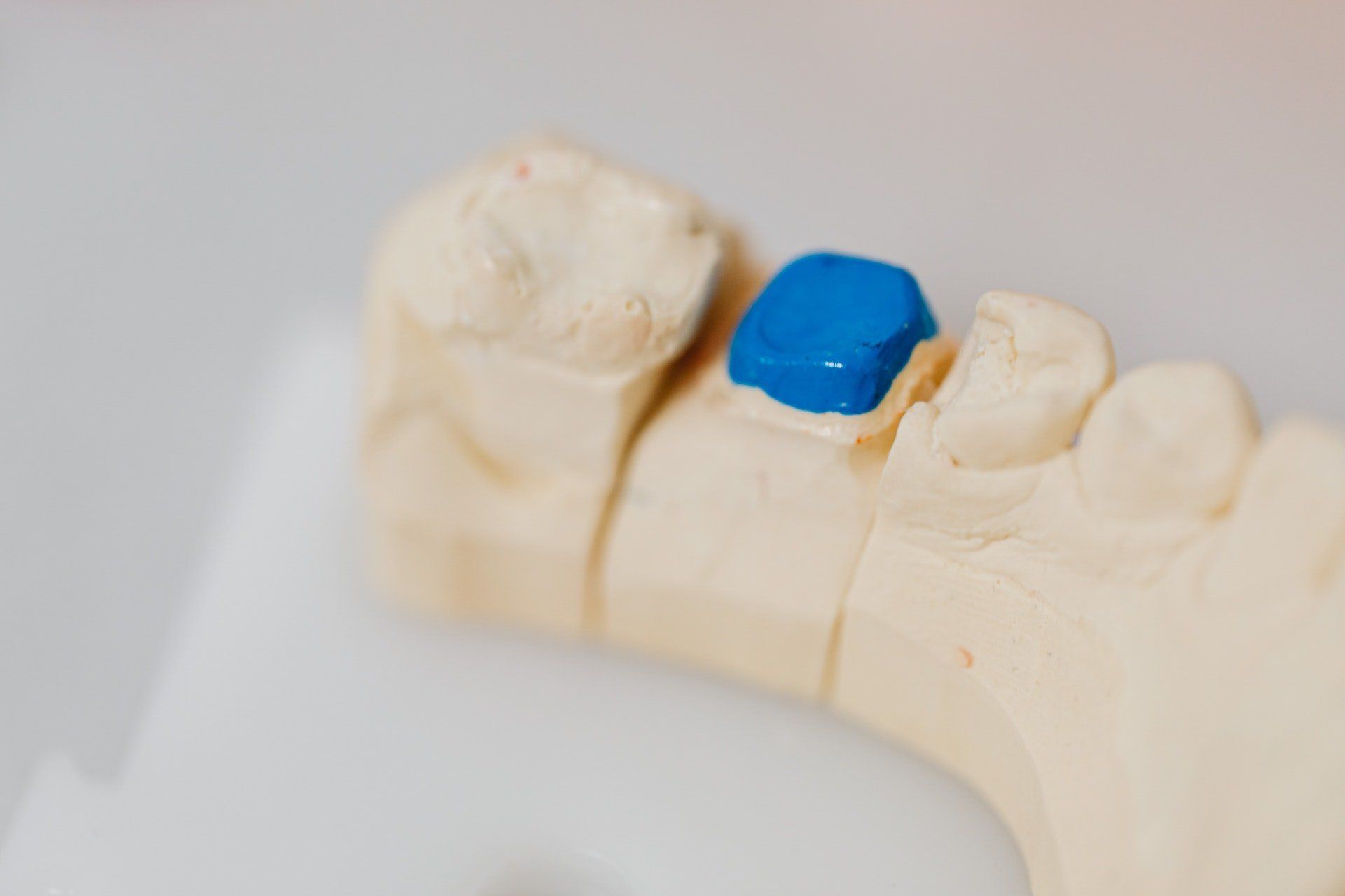 blue dental crown covering