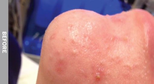 Close-up of a person's knee with visible blemishes and redness, labeled 