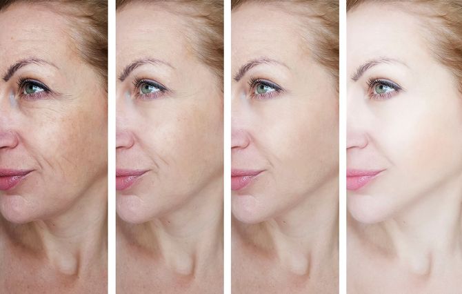 Four photos show a woman's face, progressively smoothed, starting with wrinkles and ending with flawless skin.