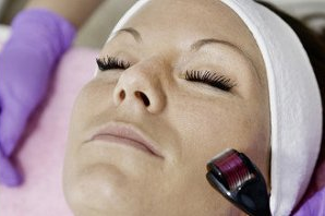 Derma Roller Facials