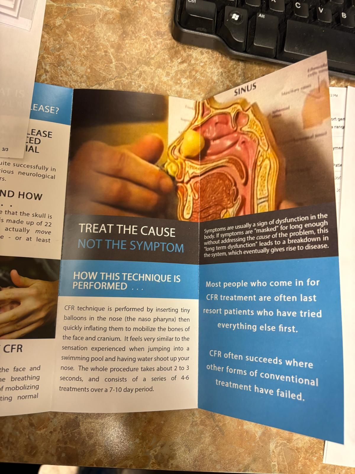 Brochure showing a hand, nasal cavity model, and text promoting treating the cause of illness.
