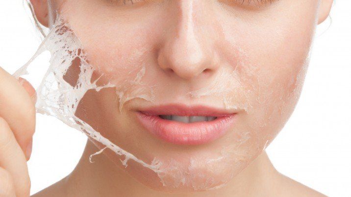Woman peeling facial skin; close-up. Light skin, neutral expression, white background.