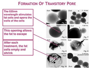 Diagram showing fat cells shrinking after treatment with 635nm wavelength to open cell walls and allow fat to escape.