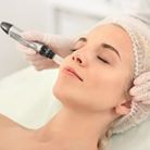 Woman receiving microneedling treatment on her face in a medical setting.